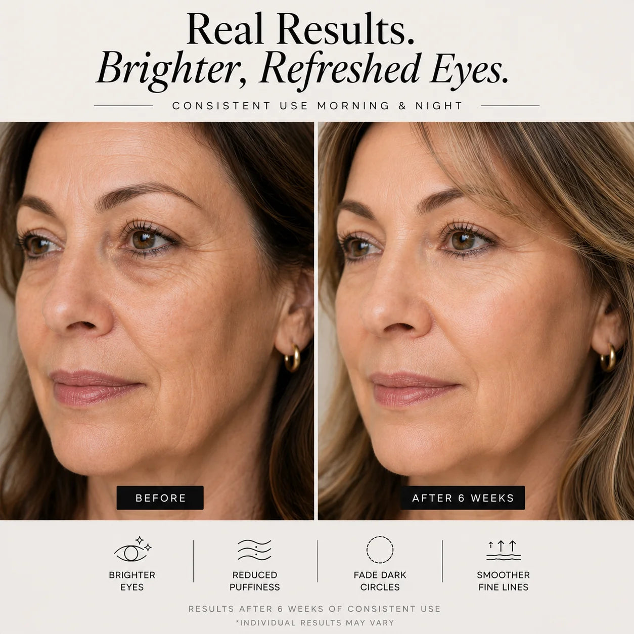 Sheskn Eye Therapy before and after 6 weeks of use