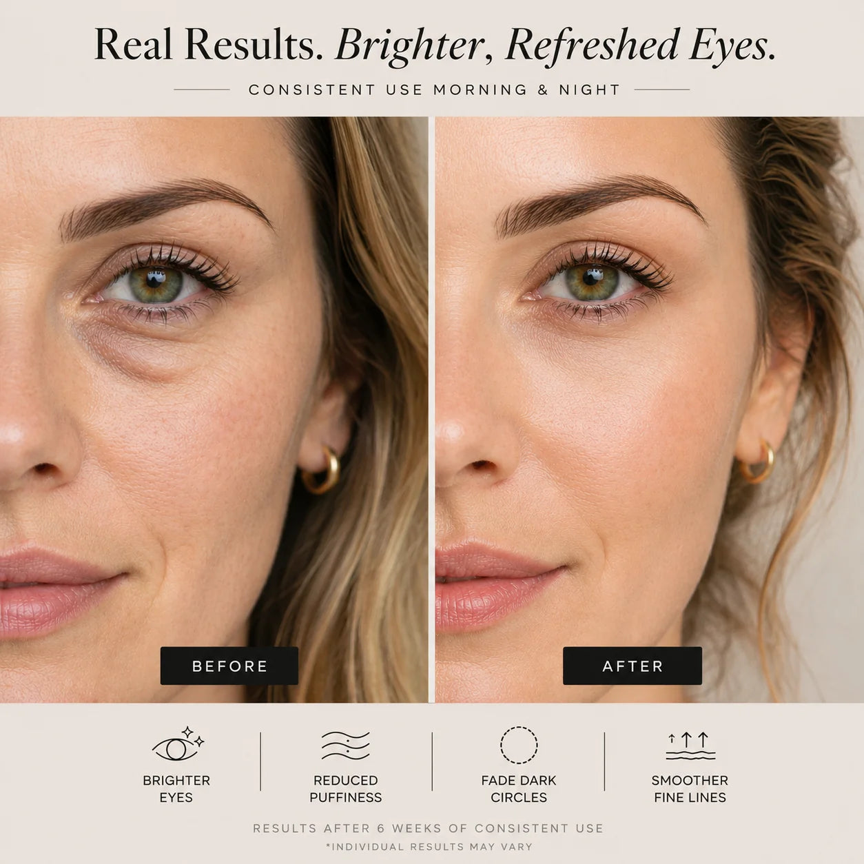 Sheskn Eye Therapy before and after under-eye results